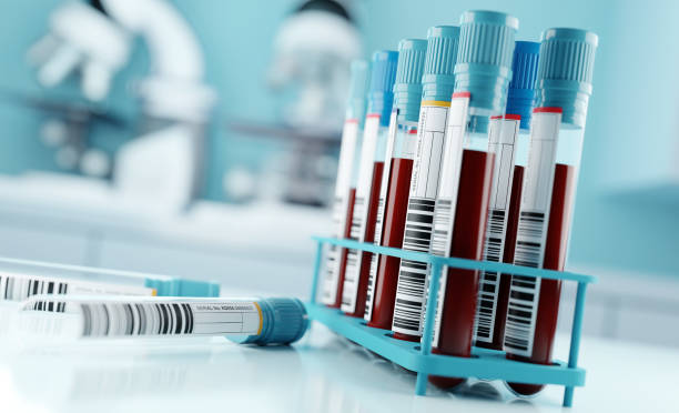 blood-test-results-in-a-medical-lab
